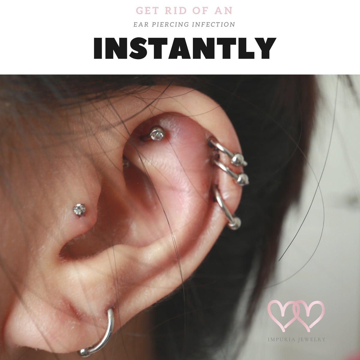 How to Get Rid of an Infected Ear Piercing Overnight