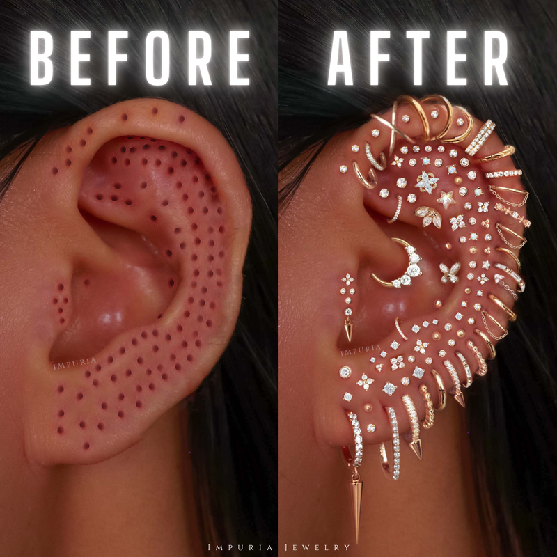 before and after ear styling for women